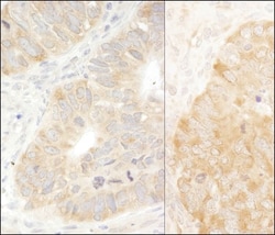 eIF2 alpha/EIF2S1 Antibody, Novus Biologicals 0.02mg; Unlabeled:Anticorps,